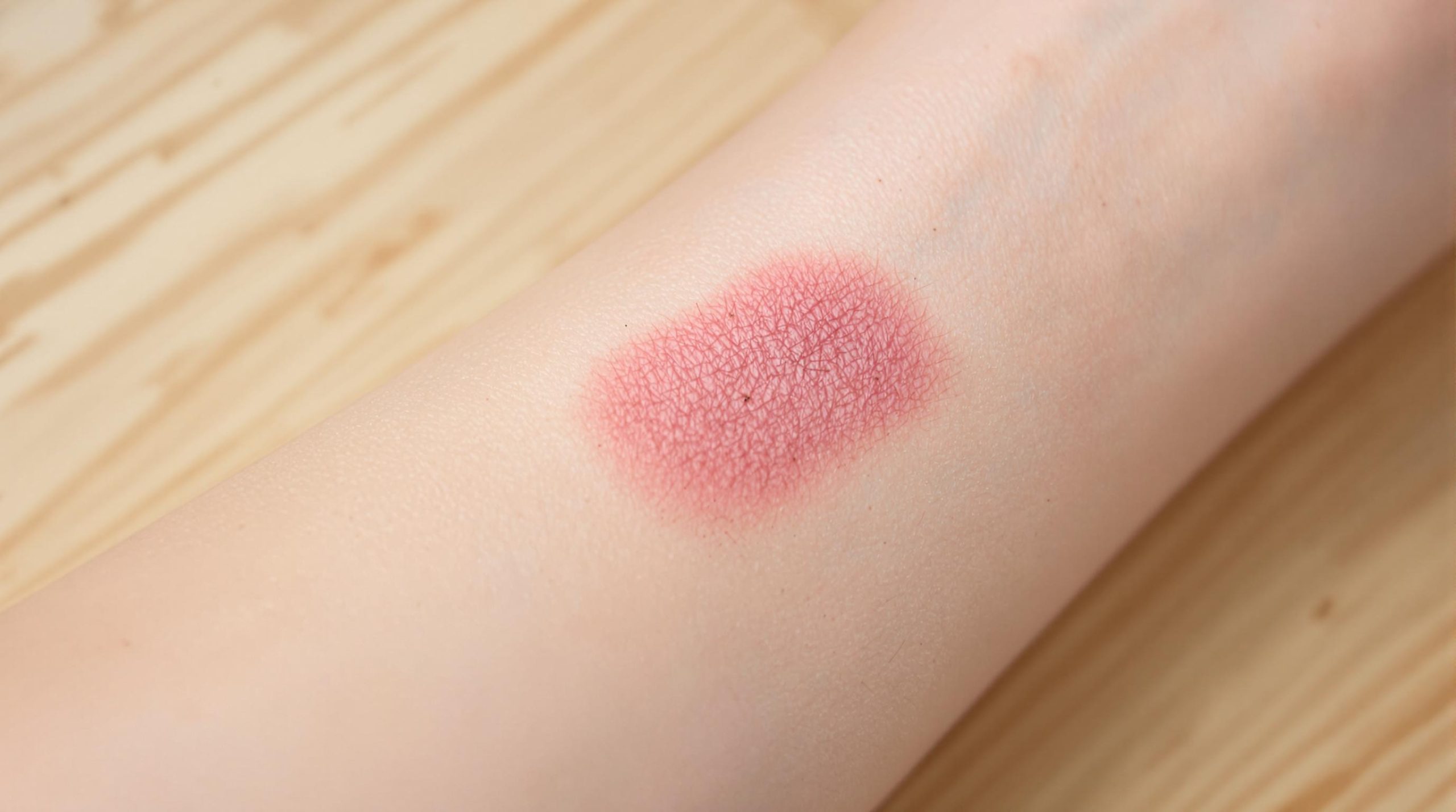 Pourquoi une cicatrice peut-elle faire mal et comment y remédier ? - Le guide ultime pour être la meilleure version de vous-même grâce au Blog Beauté